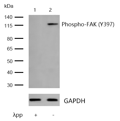 FAK (Phospho-Y397) Rabbit mAb