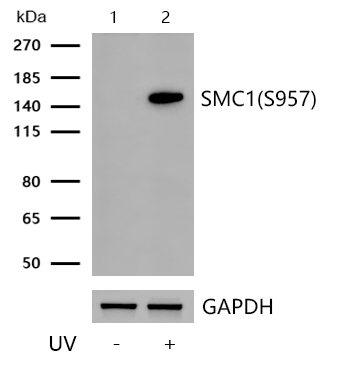 SMC1(Phospho-S957) Rabbit mAb