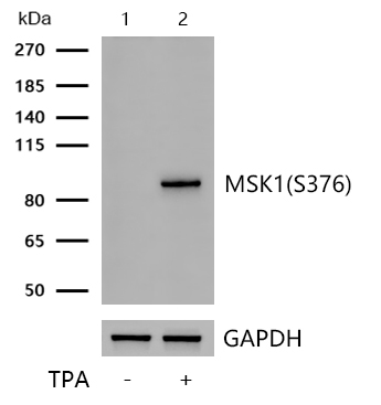 MSK1(Phospho-S376) Rabbit mAb