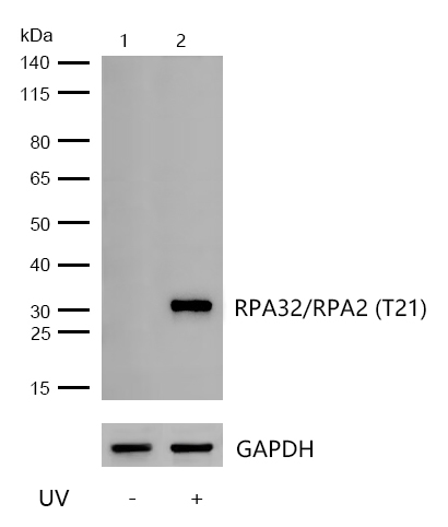 RPA32/RPA2 (Phospho-T21) Rabbit mAb
