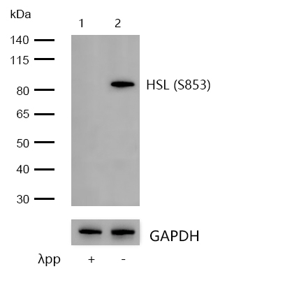 Hormone sensitive lipase (Phospho-S853) Rabbit mAb