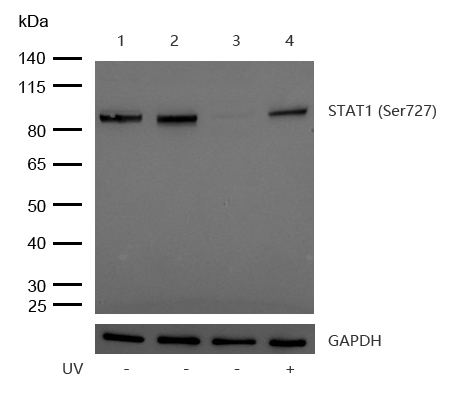 STAT1(Phospho-S727) Rabbit mAb
