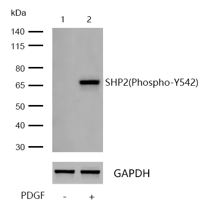 SHP2(Phospho-Y542) Rabbit mAb