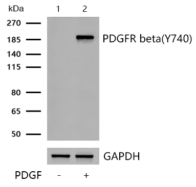 PDGF Receptor beta(Phospho-Y740) Rabbit mAb