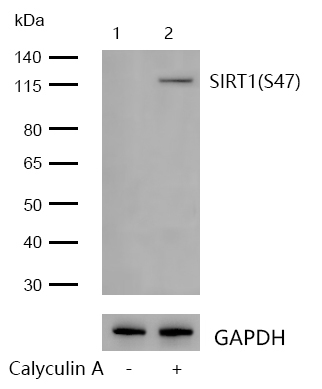 SIRT1(Phospho-S47) Rabbit mAb