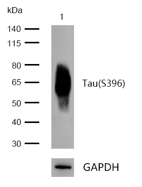 Tau(Phospho-S396) Rabbit mAb
