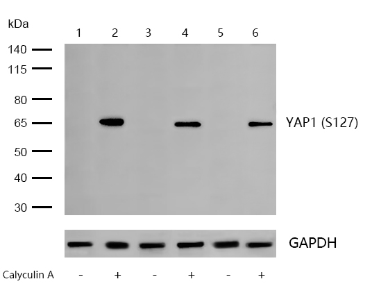 YAP1 (Phospho-S127) Rabbit mAb