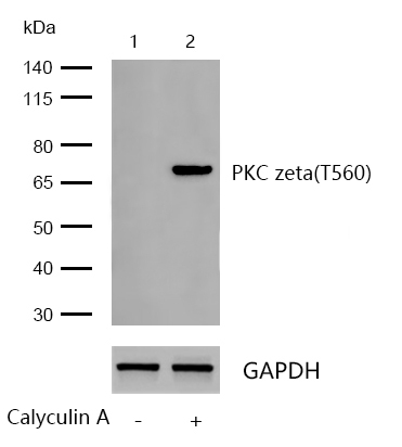 PKC zeta(Phospho-T560) Rabbit mAb