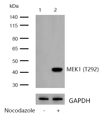MEK1 (Phospho-T292) Rabbit mAb