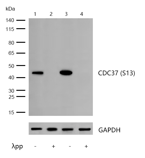 CDC37 (Phospho-S13) Rabbit mAb