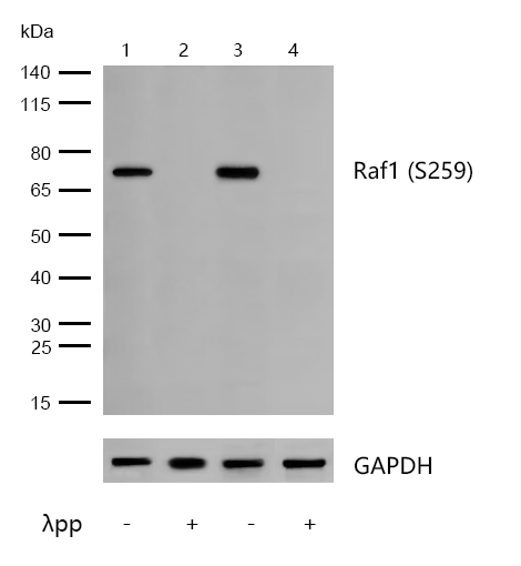 Raf1 (Phospho-S259) Rabbit mAb