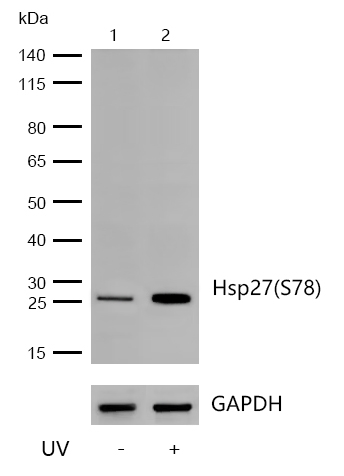 Hsp27(Phospho-S78) Rabbit mAb
