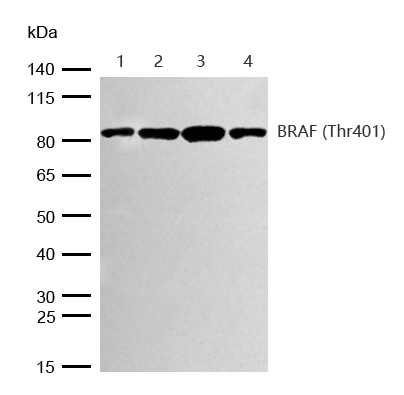 B Raf(Phospho-T401) Rabbit mAb