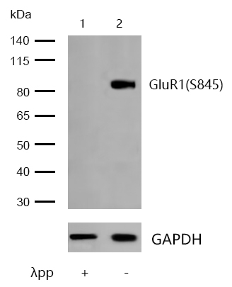 GluR1(Phospho-S845) Rabbit mAb