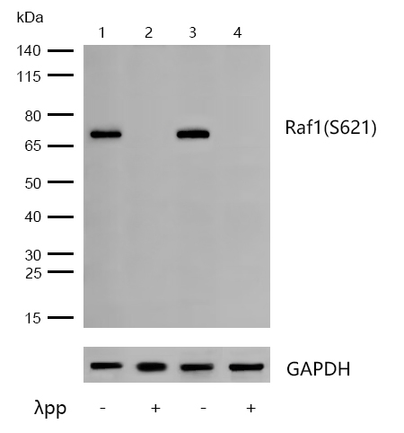 Raf1(Phospho-S621) Rabbit mAb