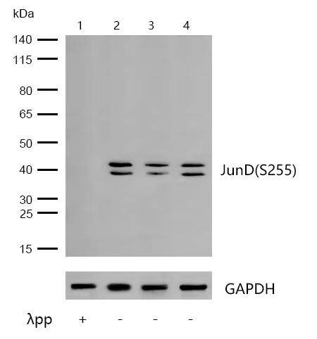 JunD(Phospho-S255) Rabbit mAb