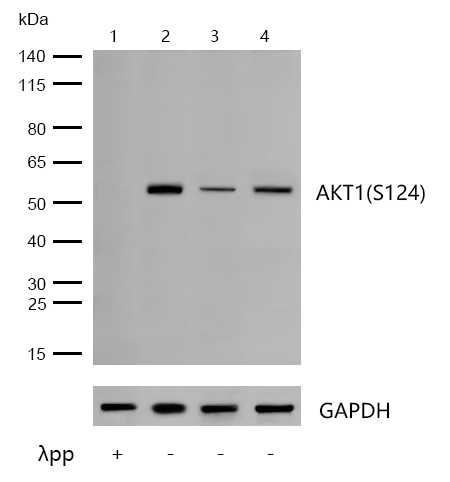 AKT1(Phospho-S124) Rabbit mAb