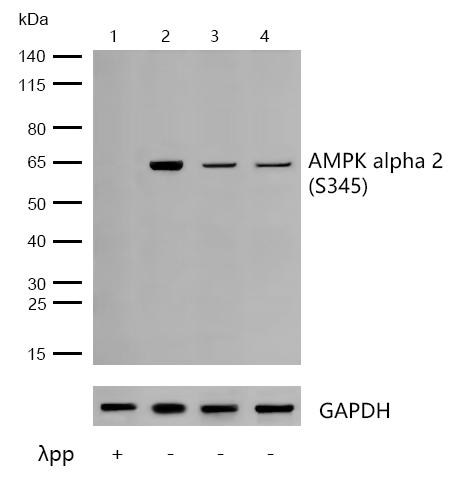 AMPK alpha 2(Phospho-S345) Rabbit mAb