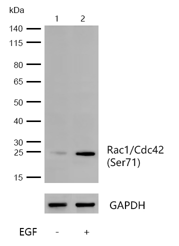 Rac1/Cdc42(Phospho-Ser71) Rabbit mAb