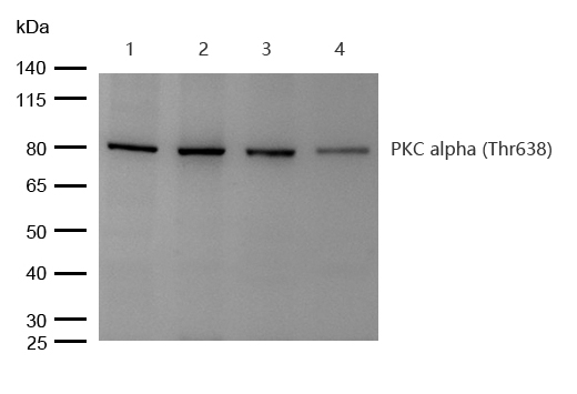 PKC alpha (Phospho-T638) Rabbit mAb