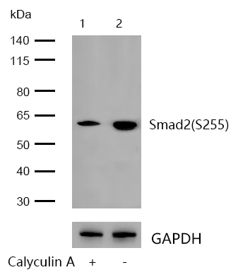 Smad2(Phospho-S255) Rabbit mAb