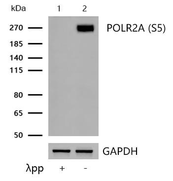 POLR2A (Phospho-S5) Rabbit mAb