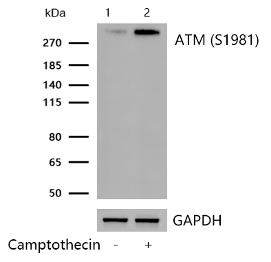 ATM (Phospho-S1981) Rabbit mAb