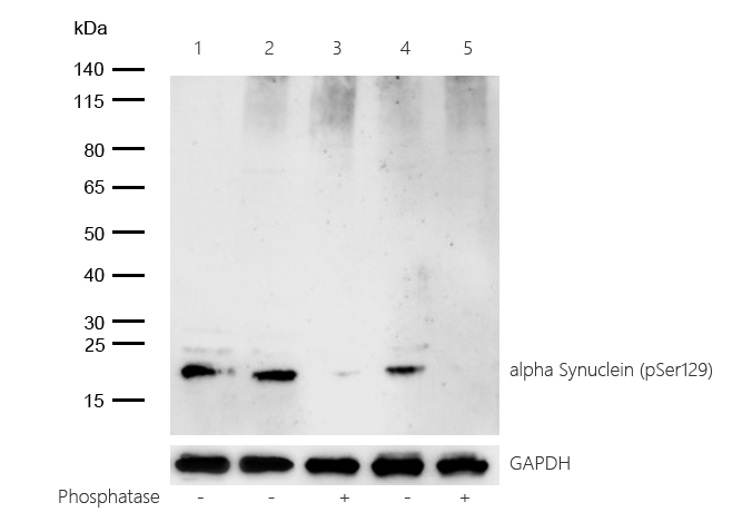 alpha Synuclein (Phospho-Ser129) Rabbit mAb