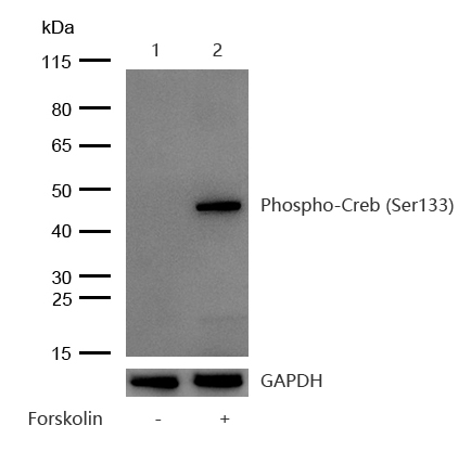 Creb (Phospho-S133) Rabbit mAb