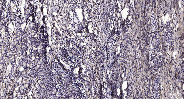 PLCγ2 (phospho-Tyr759) rabbit pAb