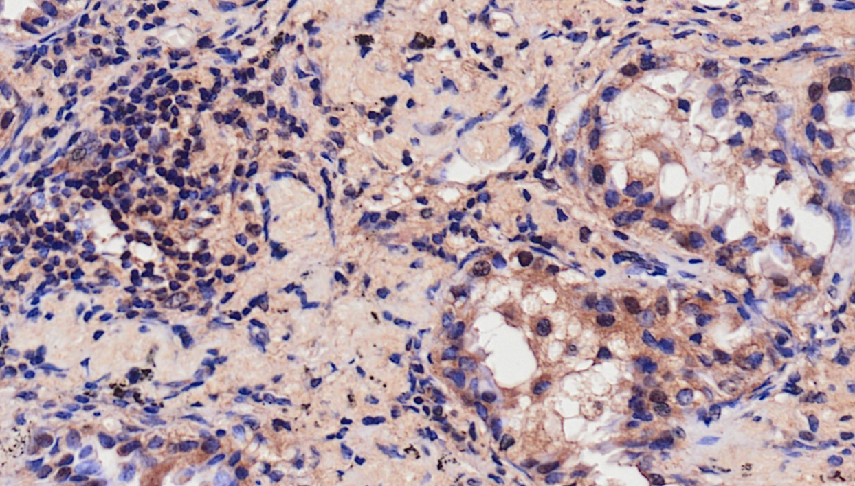 ERα (phospho Ser118) Polyclonal Antibody