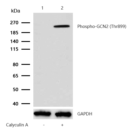GCN2 (Phospho-Thr899) Rabbit mAb