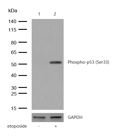 p53 (Phospho-Ser33) Rabbit mAb