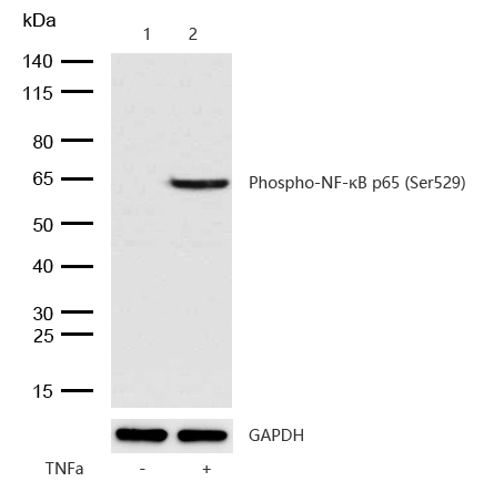 NF-κB p65 (Phospho-Ser529) Rabbit mAb