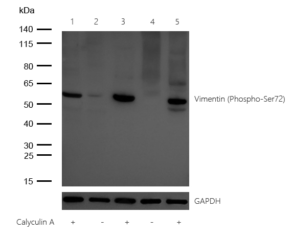 Vimentin (Phospho-Ser72) Rabbit mAb