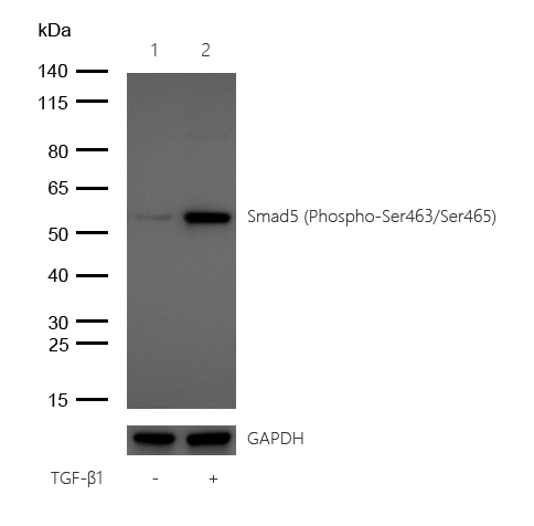 Smad5 (Phospho-Ser463/Ser465) Rabbit mAb