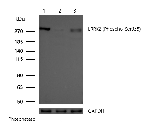 LRRK2 (Phospho-Ser935) Rabbit mAb