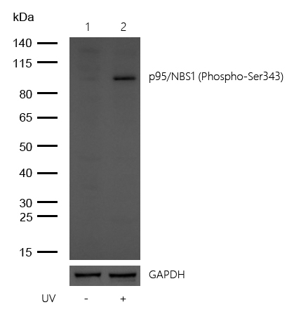 p95/NBS1 (Phospho-Ser343) Rabbit mAb