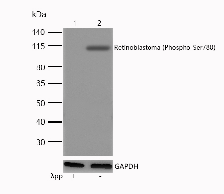 Retinoblastoma (Phospho-Ser780) Rabbit mAb