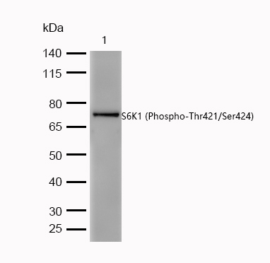 S6K1 (Phospho-Thr421/Ser424) Rabbit mAb