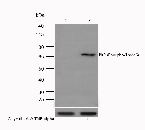 PKR (Phospho-Thr446) Rabbit mAb