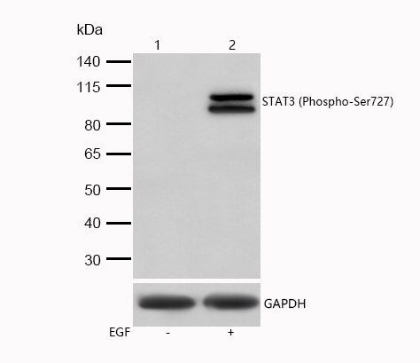 STAT3 (Phospho-Ser727) Rabbit mAb