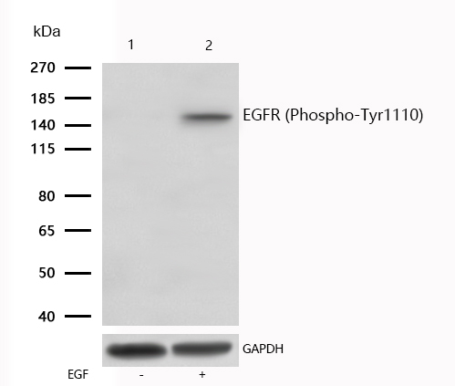 EGFR (Phospho-Tyr1110) Rabbit mAb