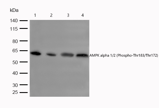 AMPK alpha 1/2 (Phospho-Thr183/Thr172) Rabbit mAb