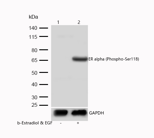 ER alpha (Phospho-Ser118) Rabbit mAb