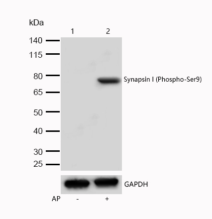 Synapsin I (Phospho-Ser9) Rabbit mAb