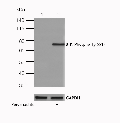 BTK (Phospho-Tyr551) Rabbit mAb