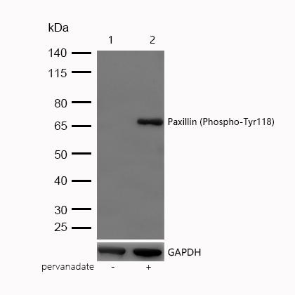 Paxillin (Phospho-Tyr118) Rabbit mAb