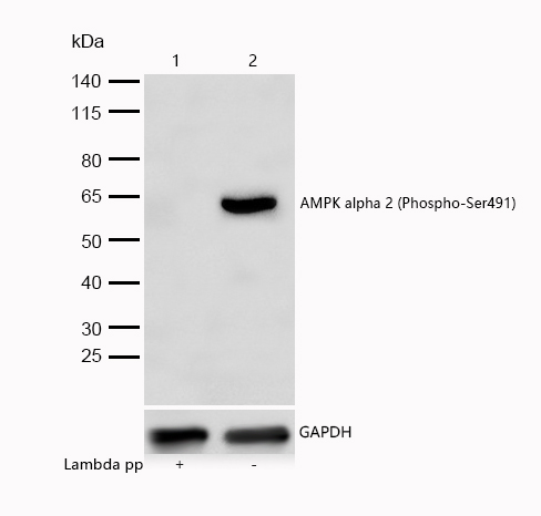 AMPK alpha 2 (Phospho-Ser491) Rabbit mAb