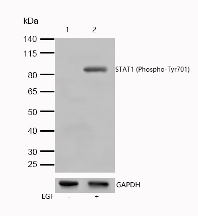 STAT1 (Phospho-Tyr701) Rabbit mAb